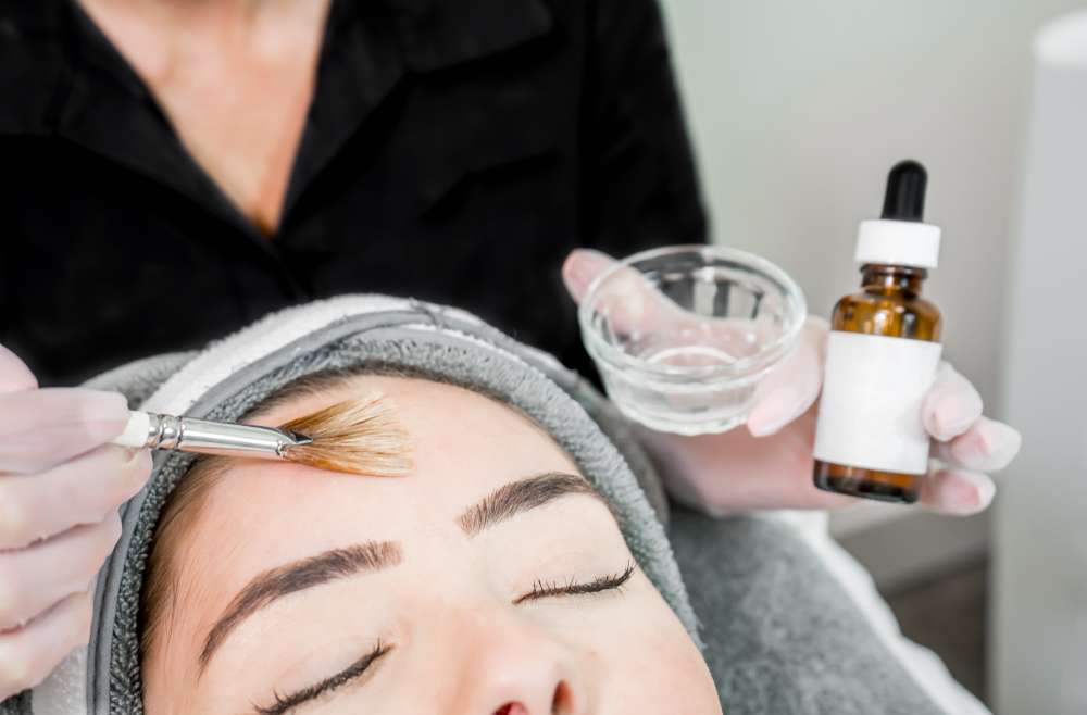 Which Chemical Peel Is Right for Me?