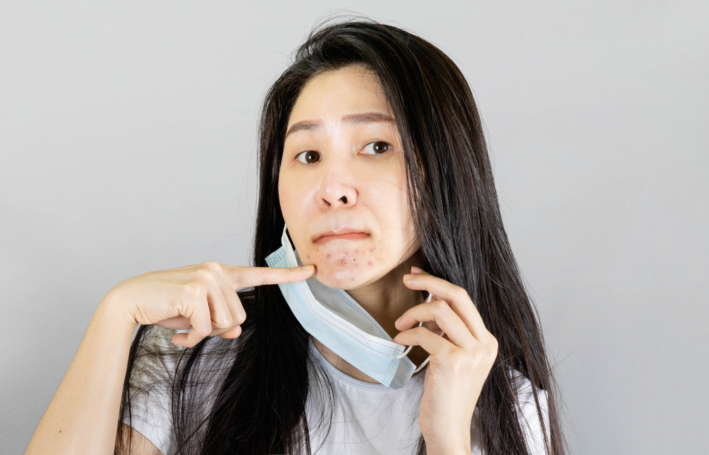 How to Find the Best Acne Doctor in Tysons Corner