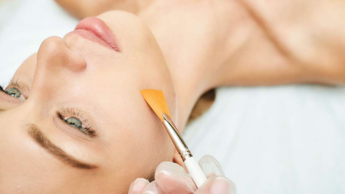 How Long Do Chemical Peels Last?