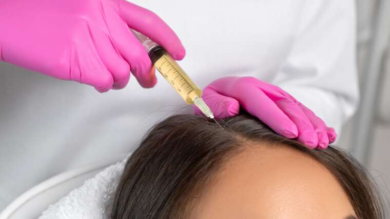 Does PRP for Hair Really Work?