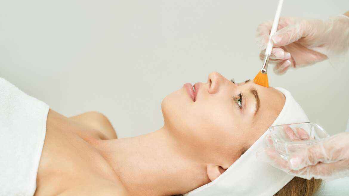 How to Prepare for Chemical Peels in Arlington, Virginia