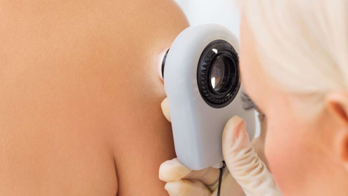 How to Find the Best Skin Cancer Doctor in Virginia