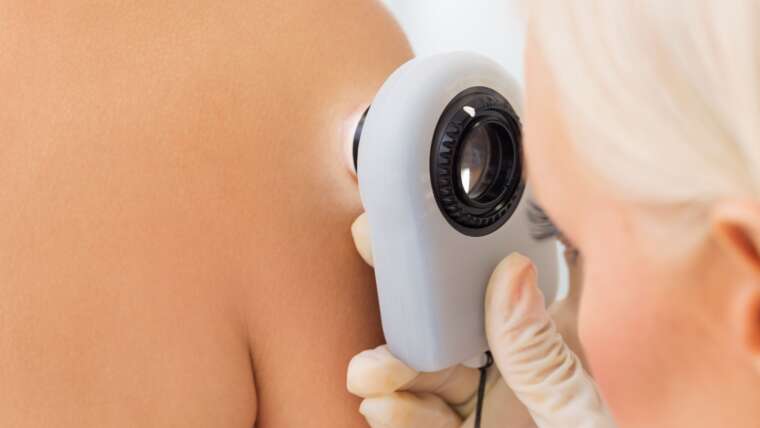 How to Find the Best Skin Cancer Doctor in Virginia
