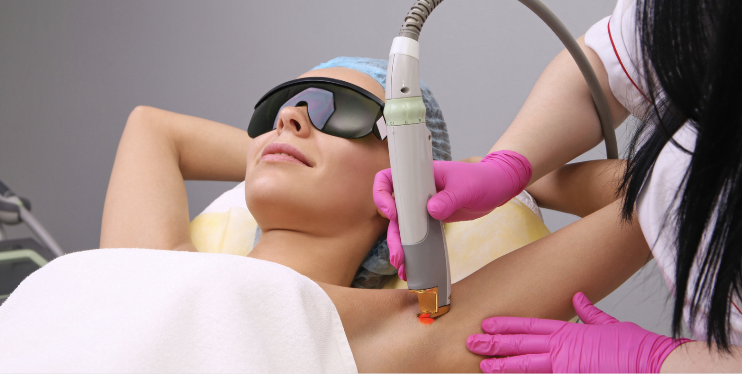 fast laser hair removal