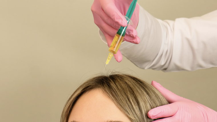 Guide to the Best PRP for Hair Loss in Arlington, Virginia