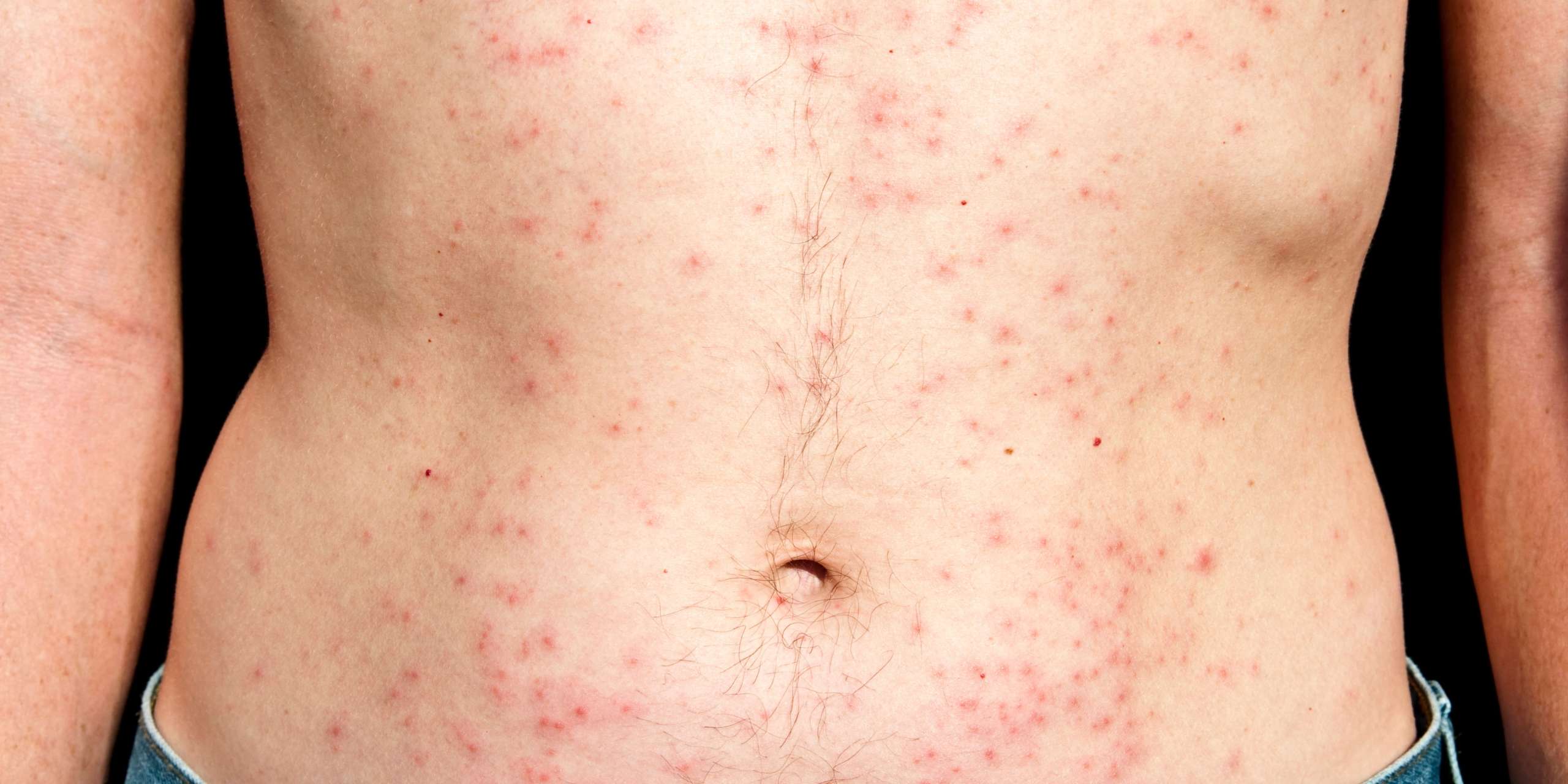 red dots on skin