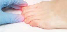 Say Goodbye to Athlete’s Foot