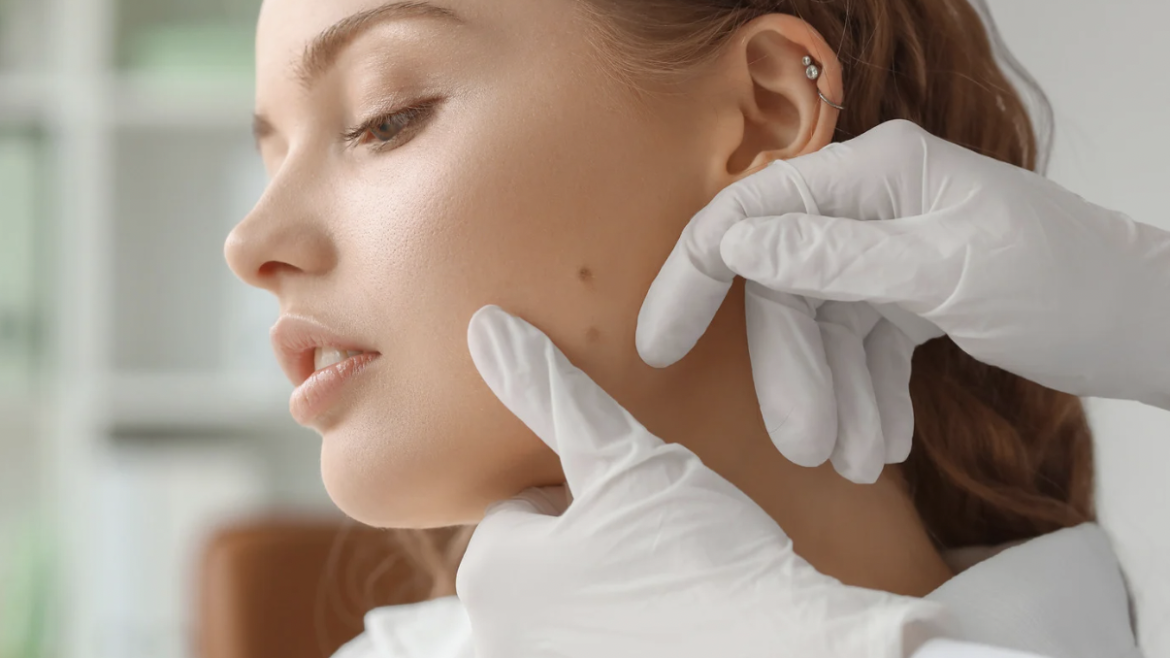 Finding the Top Dermatologist in VA