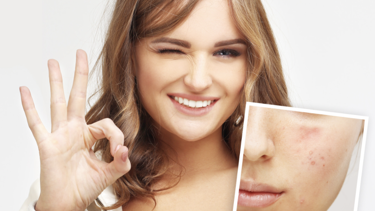 Best Acne Specialist in Arlington