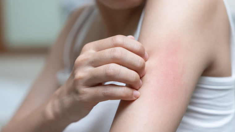 Same-Day Rash Appointment in Virginia