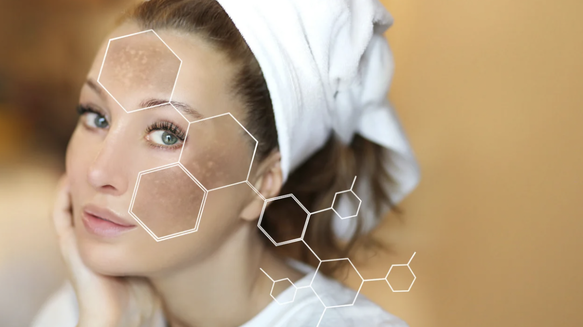 Comprehensive Melasma Treatment Options in Northern Virginia