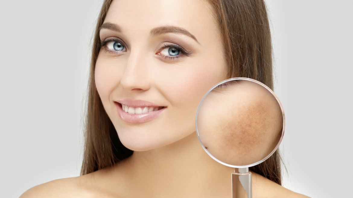 Top-Rated Melasma Treatment Clinic in Northern Virginia