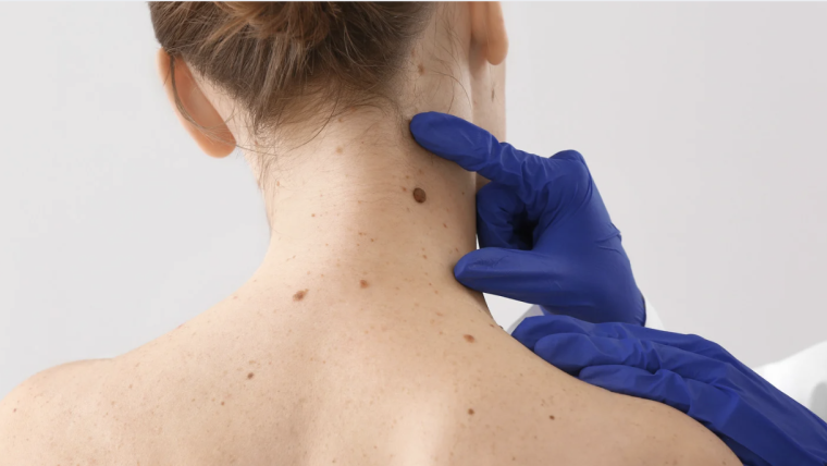How to Find the Best Dermatologist in Arlington, Virginia