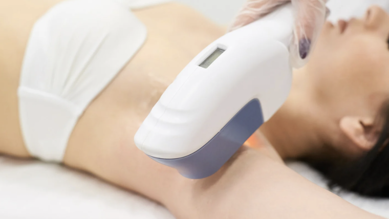 How Much Does Laser Hair Removal Cost in Fairfax, Virginia