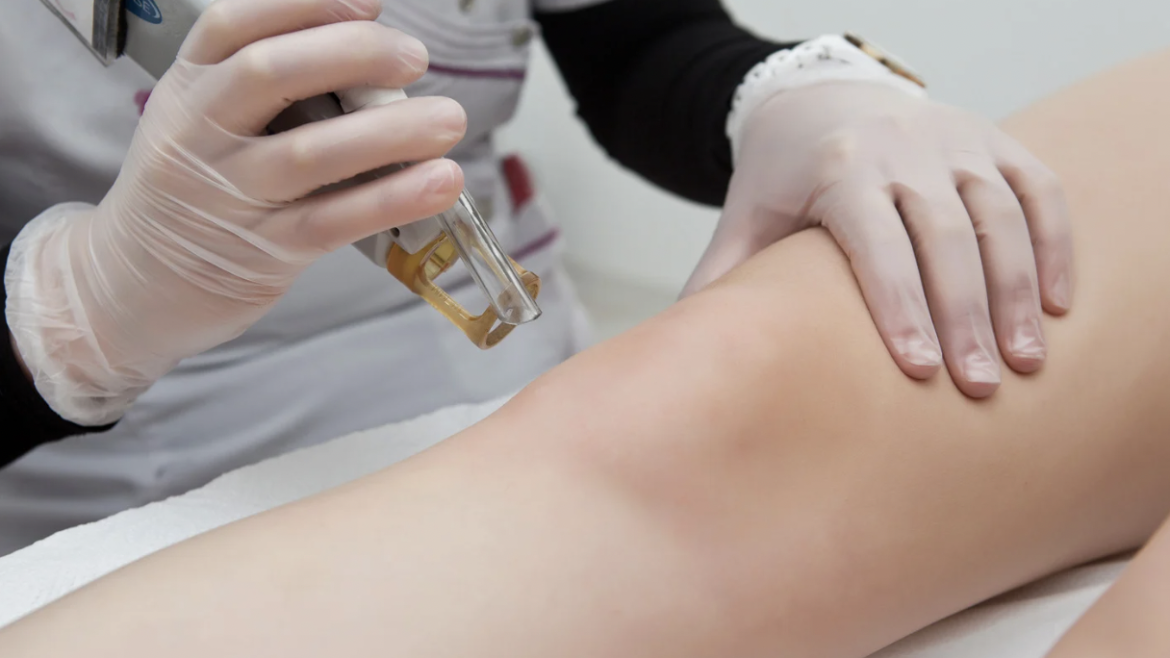 Top-Rated Laser Hair Removal Clinics in Alexandria, Virginia