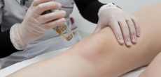 Top-Rated Laser Hair Removal Clinics in Alexandria, Virginia