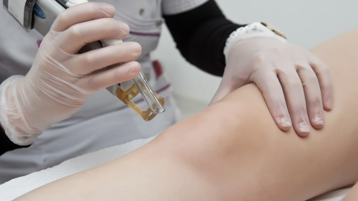 Same-Day Laser Hair Removal in Arlington, Virginia