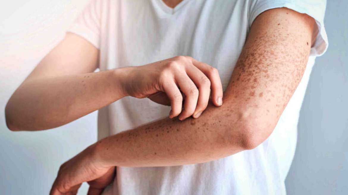 Skin Rash and Itching Evaluation Appointment Near McLean, VA