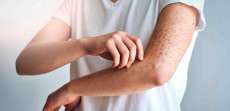 Skin Rash and Itching Evaluation Appointment Near McLean, VA