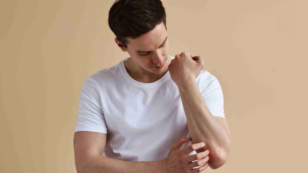 Dermatologist for Psoriasis Treatment Near Tysons Corner, Virginia