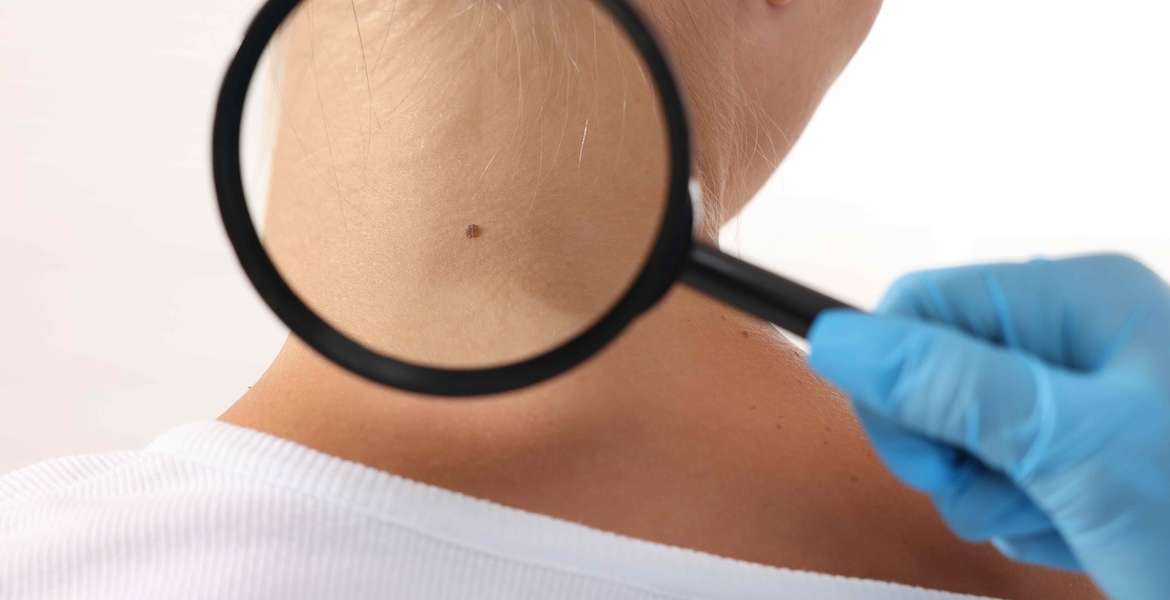 Book Urgent Dermatology Visit Near Loudoun County, Virginia