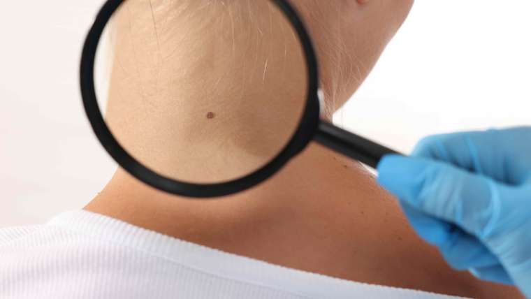 Book Urgent Dermatology Visit Near Loudoun County, Virginia