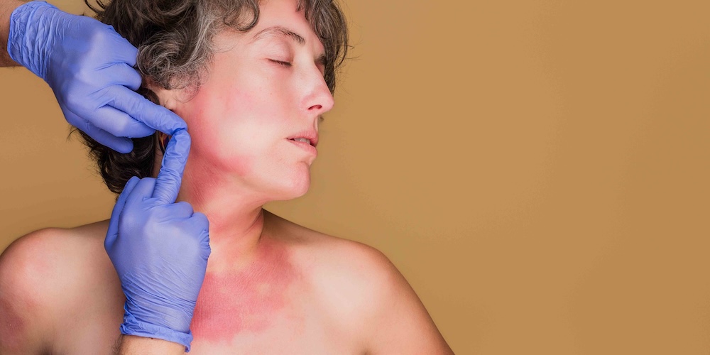 Find a Dermatologist Near Arlington, Virginia for Acne and Rashes