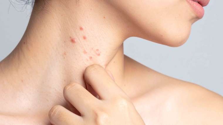 Same-Day Dermatologist Appointment Near McLean, Virginia