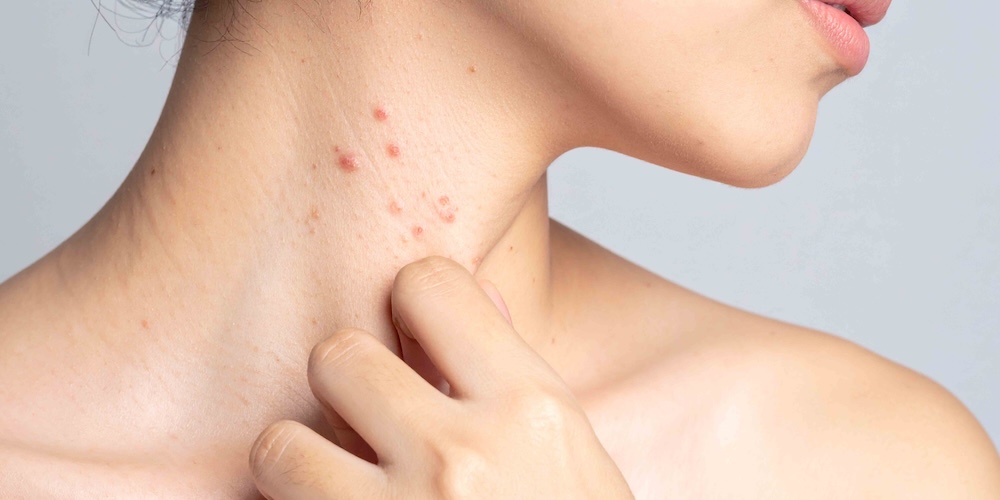 Same-Day Dermatologist Appointment Near McLean, Virginia