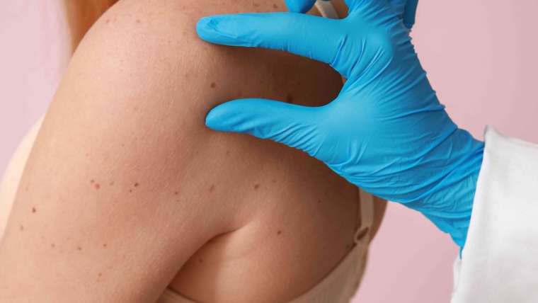 New Patient Dermatology Appointment Near Herndon, Virginia