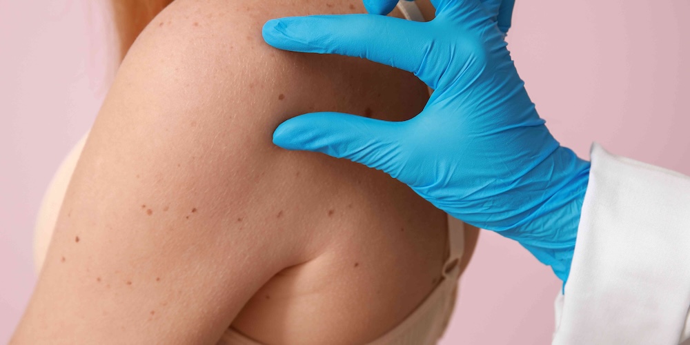 New Patient Dermatology Appointment Near Herndon, Virginia