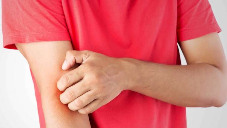 Dermatology Appointment Near Leesburg, Virginia for Eczema