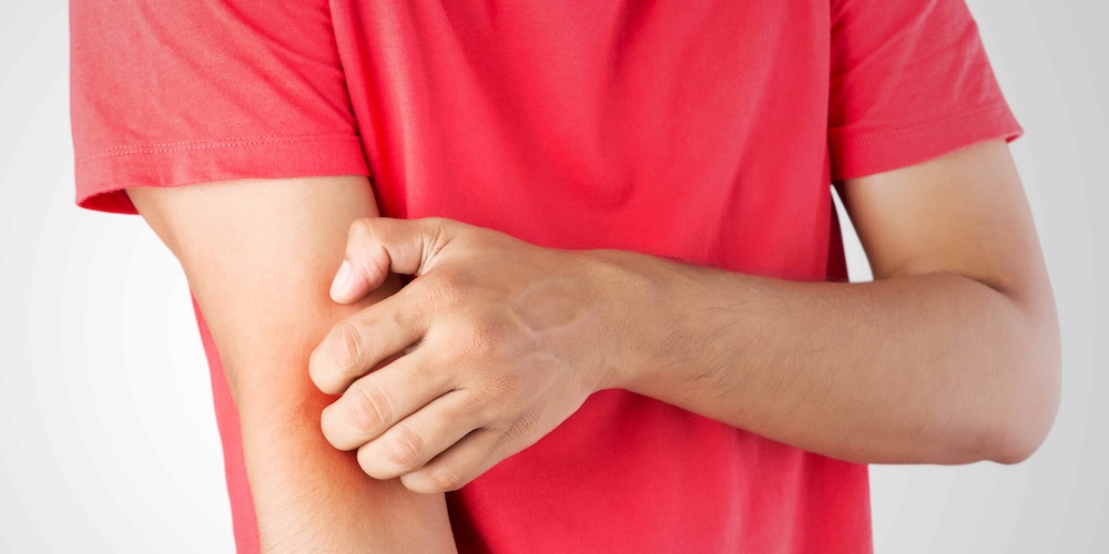 Dermatology Appointment Near Leesburg, Virginia for Eczema