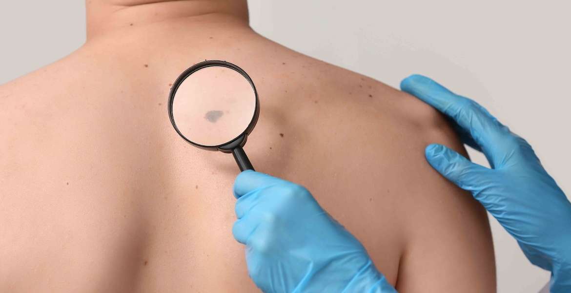 Dermatology Consultation Near Fairfax, Virginia