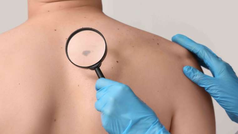 Dermatology Consultation Near Fairfax, Virginia