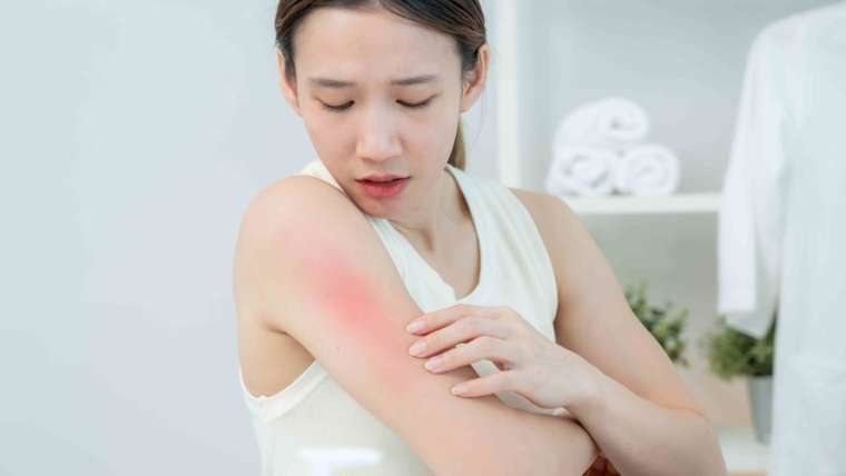 Skin Infection Treatment with a Dermatologist in McLean, Virginia