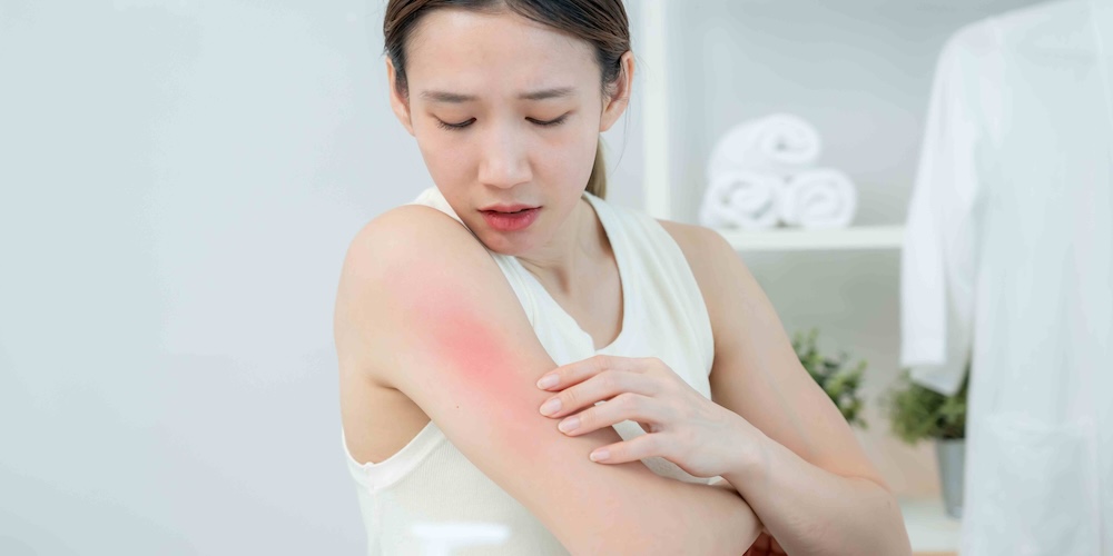 Skin Infection Treatment with a Dermatologist in McLean, Virginia