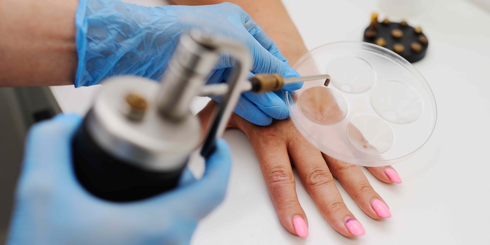 Dermatologist Accepting New Patients Near Tysons Corner, Virginia