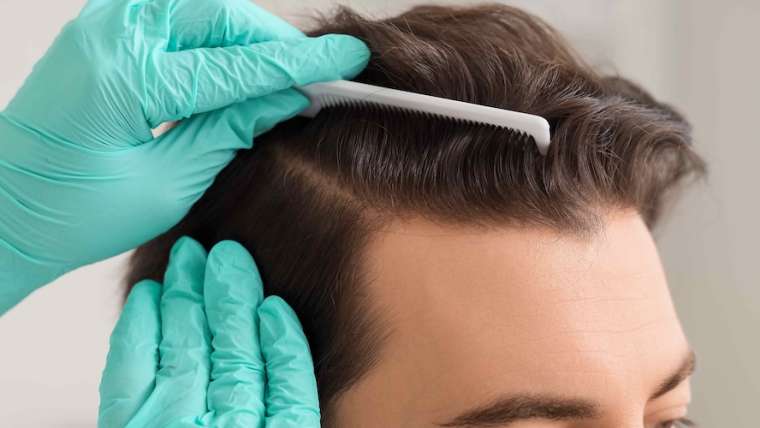 Dermatology Appointment Near Reston, Virginia for Hair Loss