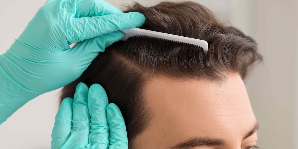 Dermatology Appointment Near Reston, Virginia for Hair Loss