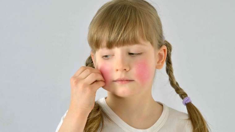 Pediatric Dermatology Appointment Near Fairfax, Virginia