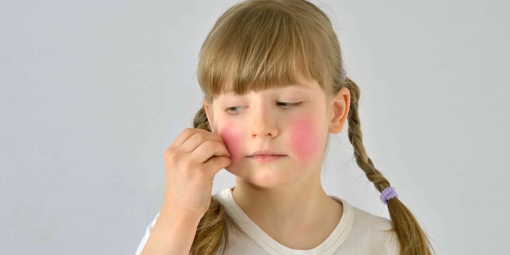 Pediatric Dermatology Appointment Near Fairfax, Virginia