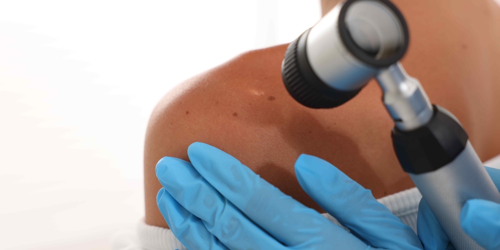 Schedule a Dermatologist Visit Near Great Falls, Virginia