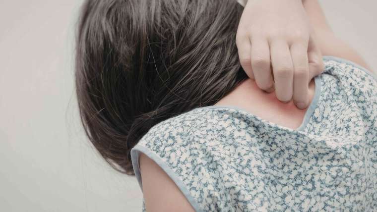 Dermatology Appointment for Unexplained Skin Irritation or Burning in McLean, Virginia