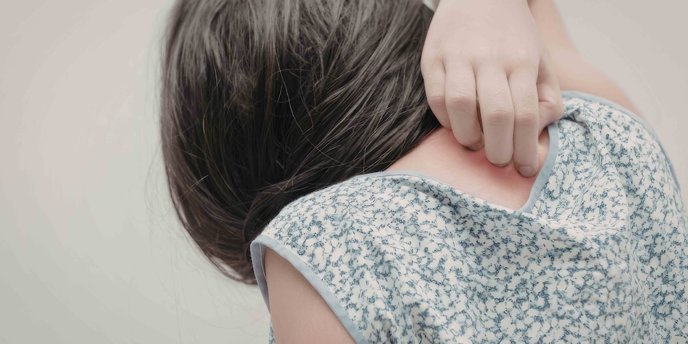 Dermatology Appointment for Unexplained Skin Irritation or Burning in McLean, Virginia