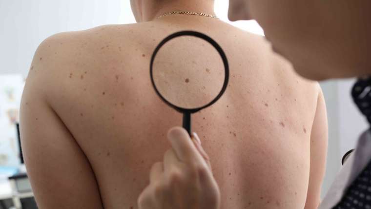 Urgent Dermatology Appointment for Itchy Skin That Won’t Go Away in Vienna, Virginia