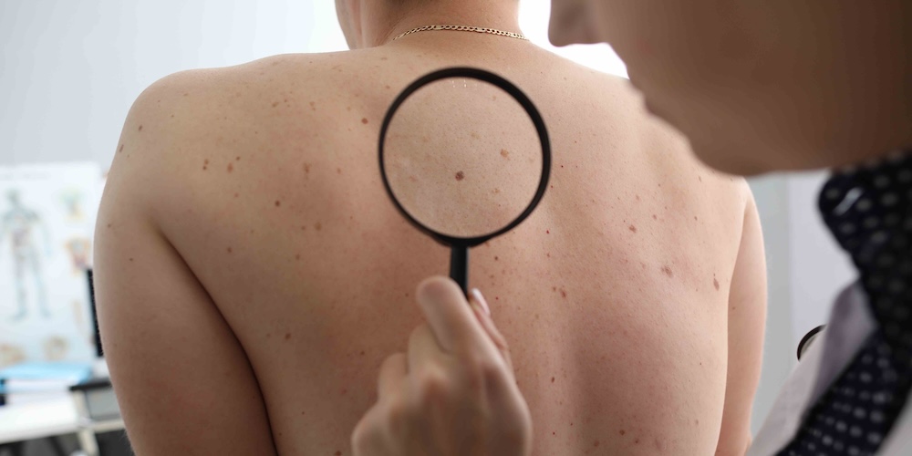 Urgent Dermatology Appointment for Itchy Skin That Won’t Go Away in Vienna, Virginia