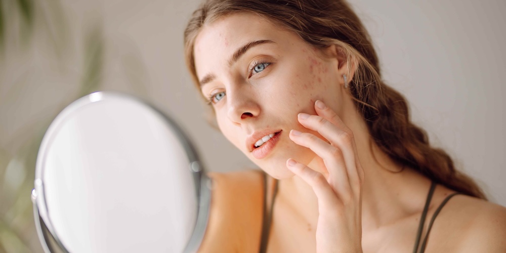 Dermatologist for Persistent Adult Acne Scarring in Falls Church, Virginia