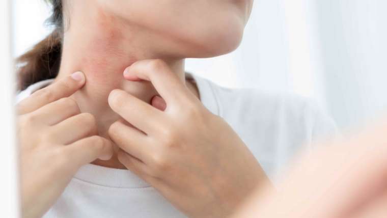 Dermatologist Appointment for Sudden Red Rash in McLean, Virginia