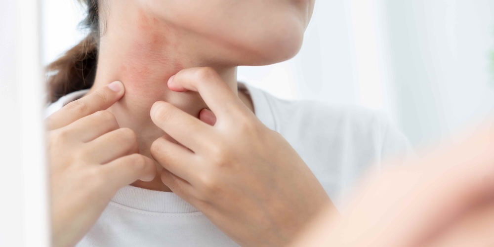 Dermatologist Appointment for Sudden Red Rash in McLean, Virginia